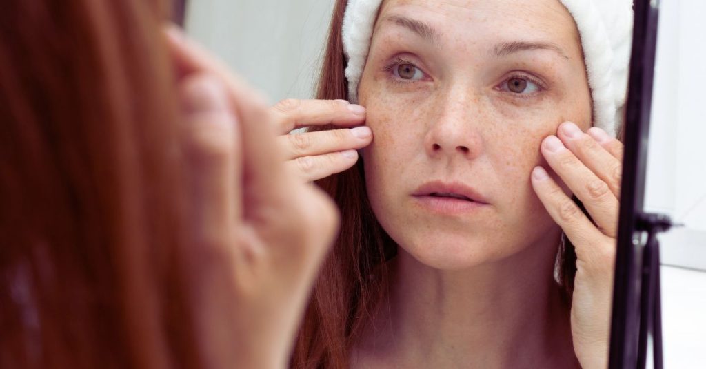 Tutto sul filler perioculare: benefici e controindicazioni Tutto sul filler perioculare: benefici e controindicazioni