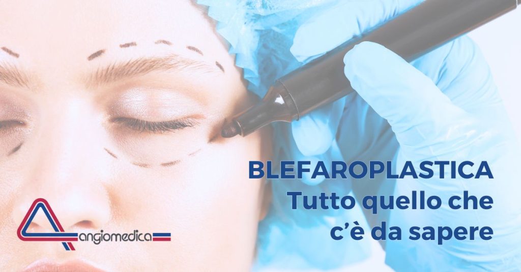 Prima e dopo la blefaroplastica: tutto sull’intervento e i risultati Prima e dopo la blefaroplastica: tutto sull’intervento e i risultati