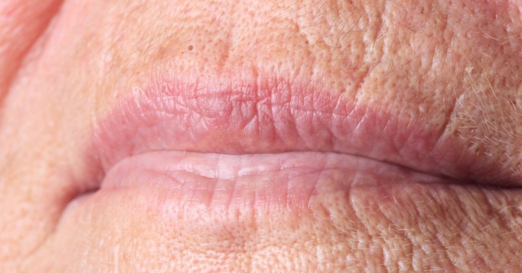 Botox: 8 applicazioni estetiche e mediche Botox: 8 applicazioni estetiche e mediche