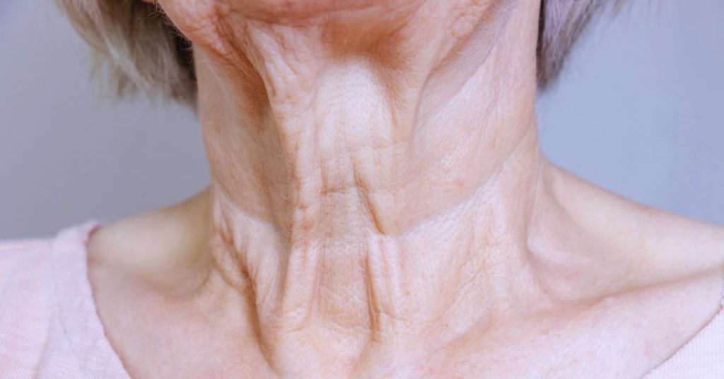 Botox: 8 applicazioni estetiche e mediche Botox: 8 applicazioni estetiche e mediche