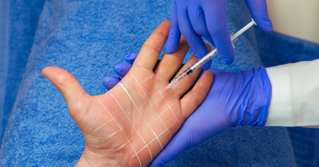 Botox: 8 applicazioni estetiche e mediche Botox: 8 applicazioni estetiche e mediche