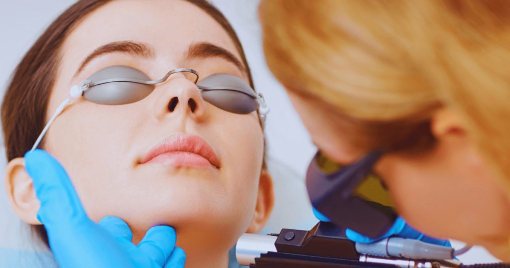 Eliminare le macchie solari: peeling e laser a confronto esecuzione di una seduta di laser transcutaneo