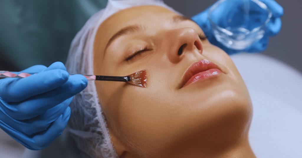 Eliminare le macchie solari: peeling e laser a confronto esecuzione di una seduta di peeling chimico