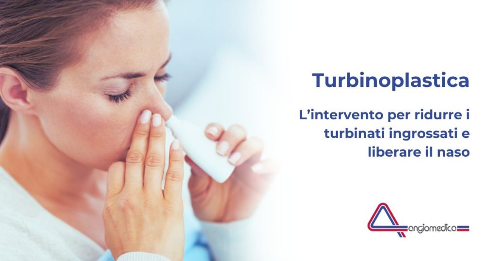 Turbinoplastica: quando i farmaci non bastano più a liberare il naso Turbinoplastica: quando i farmaci non bastano più a liberare il naso